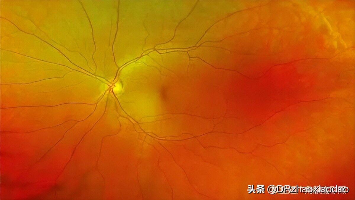 第一讲(2)眼睛的解剖结构